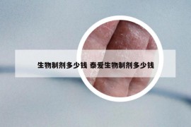 生物制劑多少錢 泰愛生物制劑多少錢