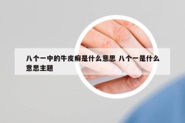 八個(gè)一中的牛皮癬是什么意思 八個(gè)一是什么意思主題