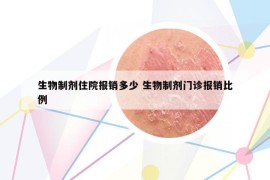生物制劑住院報(bào)銷(xiāo)多少 生物制劑門(mén)診報(bào)銷(xiāo)比例