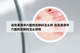 自貢夏洞寺六醫(yī)院皮膚科怎么樣 自貢夏洞寺六醫(yī)院皮膚科怎么樣呀
