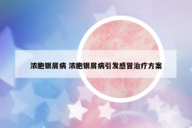 濃胞銀屑病 濃胞銀屑病引發(fā)感冒治療方案
