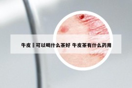 牛皮廯可以喝什么茶好 牛皮茶有什么藥用