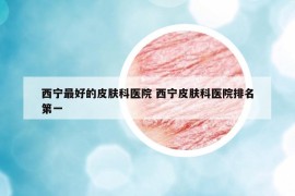 西寧最好的皮膚科醫(yī)院 西寧皮膚科醫(yī)院排名第一