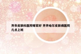 齊市皮膚科醫(yī)院哪家好 齊齊哈爾皮膚病醫(yī)院幾點(diǎn)上班