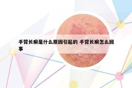 手臂長癬是什么原因引起的 手臂長癬怎么回事