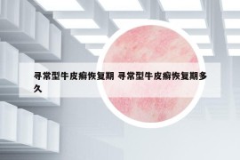 尋常型牛皮癬恢復(fù)期 尋常型牛皮癬恢復(fù)期多久