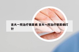 吉大一院治療銀屑病 吉大一院治療銀屑病打針