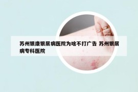 蘇州銀康銀屑病醫(yī)院為啥不打廣告 蘇州銀屑病?？漆t(yī)院