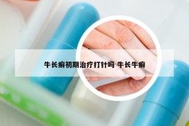 牛長癬初期治療打針嗎 牛長牛癬