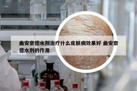 曲安奈德水劑治療什么皮膚病效果好 曲安奈德水劑的作用