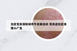 社區(qū)黨員清除城市牛皮癬活動(dòng) 黨員進(jìn)社區(qū)清理小廣告
