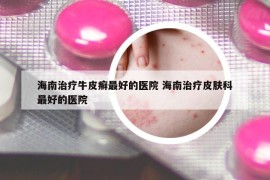 海南治療牛皮癬最好的醫(yī)院 海南治療皮膚科最好的醫(yī)院
