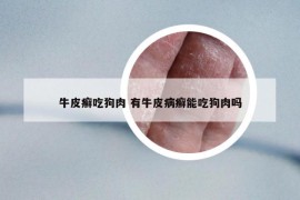 牛皮癬吃狗肉 有牛皮病癬能吃狗肉嗎