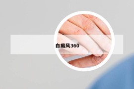 白癜風(fēng)360