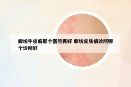 廊坊牛皮癬那個(gè)醫(yī)院再好 廊坊皮膚病診所哪個(gè)診所好