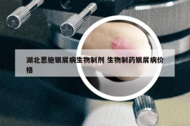 湖北恩施銀屑病生物制劑 生物制藥銀屑病價格