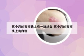 五個月的寶寶頭上有一塊塊白 五個月的寶寶頭上有白斑