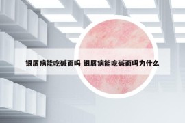 銀屑病能吃堿面嗎 銀屑病能吃堿面嗎為什么