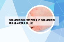 多烯磷脂酰膽堿價(jià)格大概多少 多烯磷脂酰膽堿價(jià)格大概多少錢一瓶