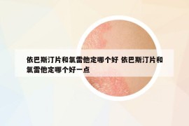 依巴斯汀片和氯雷他定哪個好 依巴斯汀片和氯雷他定哪個好一點
