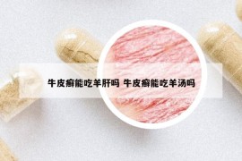 牛皮癬能吃羊肝嗎 牛皮癬能吃羊湯嗎