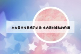 土大黃治皮膚病的方法 土大黃對(duì)皮膚的作用