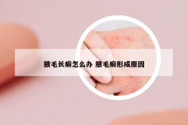 腋毛長癬怎么辦 腋毛癬形成原因