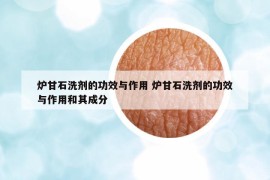 爐甘石洗劑的功效與作用 爐甘石洗劑的功效與作用和其成分