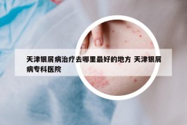 天津銀屑病治療去哪里最好的地方 天津銀屑病?？漆t(yī)院