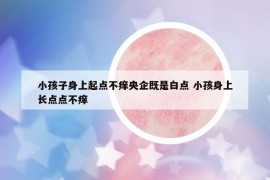 小孩子身上起點(diǎn)不癢央企既是白點(diǎn) 小孩身上長(zhǎng)點(diǎn)點(diǎn)不癢
