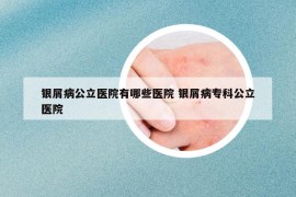 銀屑病公立醫(yī)院有哪些醫(yī)院 銀屑病?？乒⑨t(yī)院
