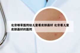 北京哪家醫(yī)院給兒童看皮膚最好 北京看兒童皮膚最好的醫(yī)院