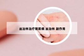 皿冶林治療銀屑病 皿治林 副作用