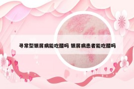 尋常型銀屑病能吃醋嗎 銀屑病患者能吃醋嗎