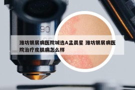 濰坊銀屑病醫(yī)院城選A孟晨星 濰坊銀屑病醫(yī)院治療皮膚病怎么樣