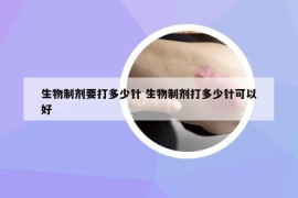 生物制劑要打多少針 生物制劑打多少針可以好