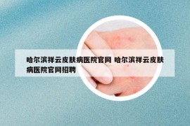 哈爾濱祥云皮膚病醫(yī)院官網(wǎng) 哈爾濱祥云皮膚病醫(yī)院官網(wǎng)招聘