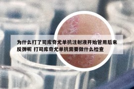 為什么打了司庫(kù)奇尤單抗注射液開始管用后來反彈呢 打司庫(kù)奇尤單抗需要做什么檢查