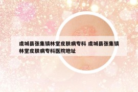 虞城縣張集鎮(zhèn)林堂皮膚病?？?虞城縣張集鎮(zhèn)林堂皮膚病?？漆t(yī)院地址