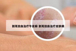 割耳放血治療牛皮癬 割耳放血治療皮膚病