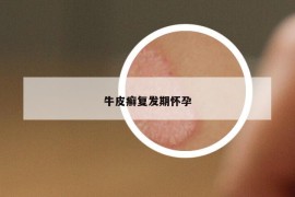 牛皮癬復(fù)發(fā)期懷孕