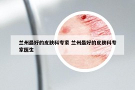 蘭州最好的皮膚科專家 蘭州最好的皮膚科專家醫(yī)生