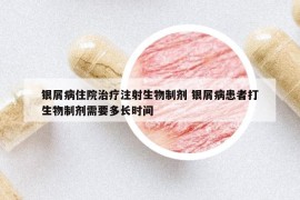 銀屑病住院治療注射生物制劑 銀屑病患者打生物制劑需要多長時間