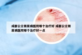 成都公立銀屑病醫(yī)院哪個(gè)治療好 成都公立銀屑病醫(yī)院哪個(gè)治療好一點(diǎn)