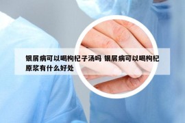 銀屑病可以喝枸杞子湯嗎 銀屑病可以喝枸杞原漿有什么好處
