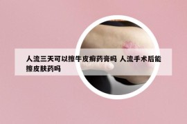 人流三天可以擦牛皮癬藥膏嗎 人流手術(shù)后能擦皮膚藥嗎