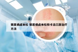 銀屑病鹵米松 銀屑病鹵米松和卡泊三醇治療方法