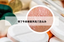 得了牛皮癬夏天出門怎么辦