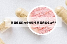 銀屑患者能吃杏鮑菇嗎 銀屑病能吃杏嗎?