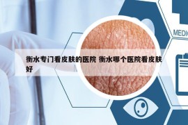 衡水專門看皮膚的醫(yī)院 衡水哪個醫(yī)院看皮膚好